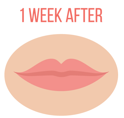 lip blushing permanent makeup - 4-weeks-later-lips